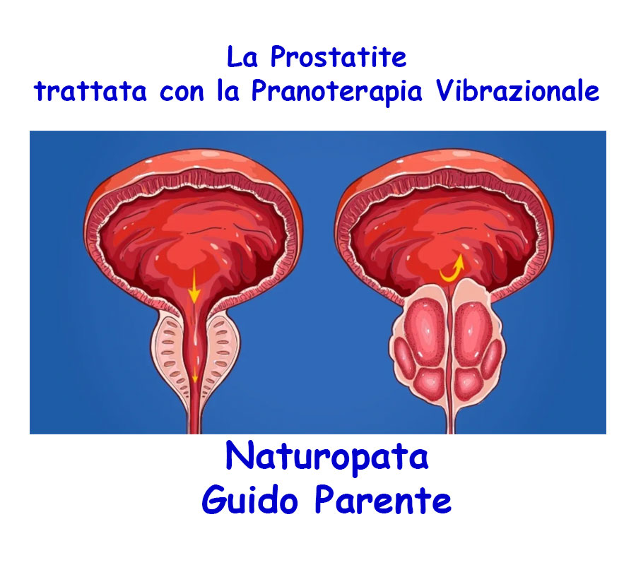 Studio Naturopatia E Pranoterapia Del Dr Guido Parente La Prostatite