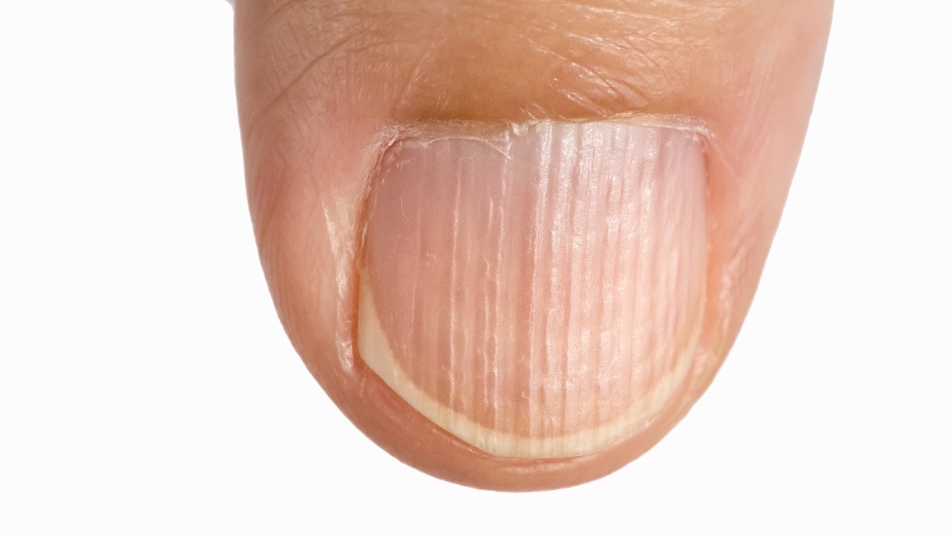 9 Signs of Protein Deficiency