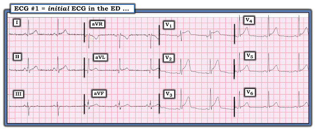 A middle-aged male with chest pain