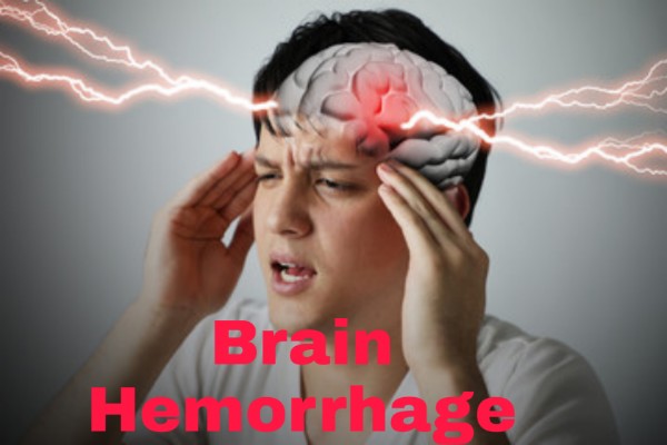 Brain Hemorrhage क्या है, से पीड़ित मनुष्य और बचने के उपाय