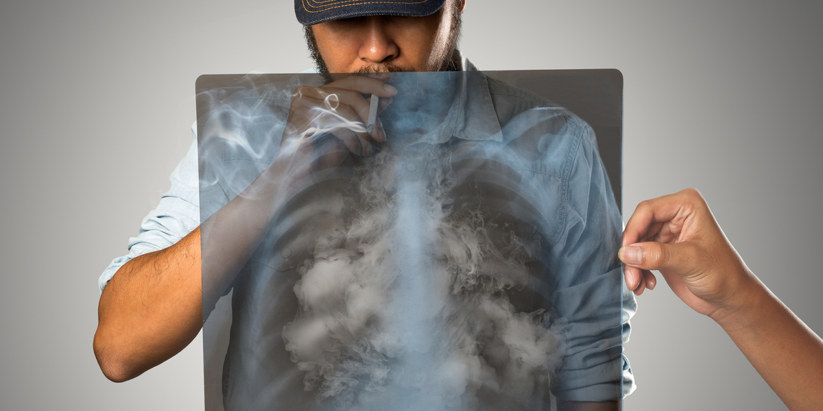 Smoking and cancer cause and effect