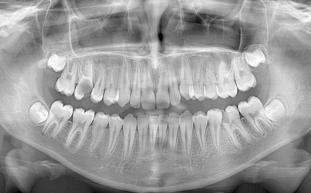 Diş hekimliğinde uzmanlık