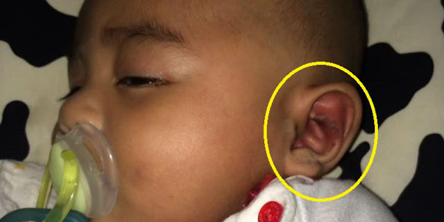Pengasuhnya Bilang Telinga anak Ini Terluka Digigit Semut. Faktanya Kejam! Pengasuhnya Bilang Telinga anak Ini Terluka Digigit Semut. Faktanya Kejam!