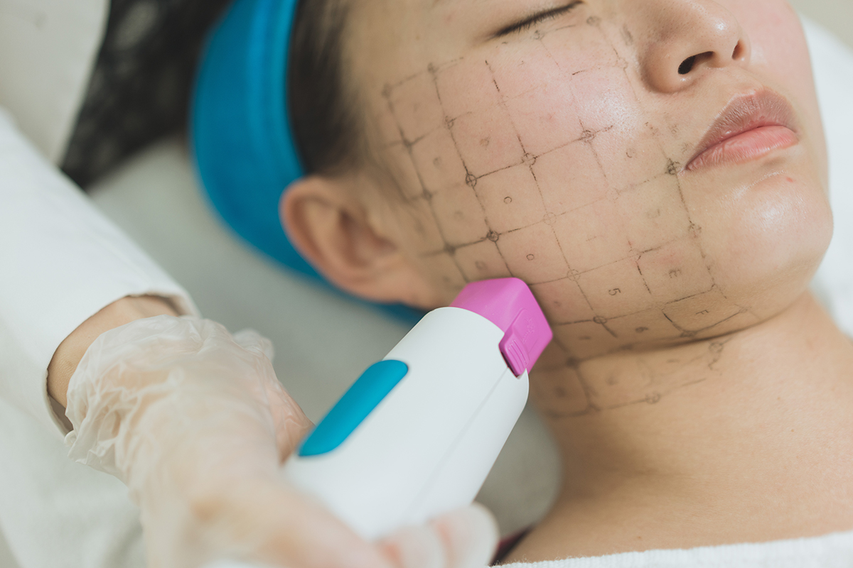 雙下巴成因雙雙下巴消脂針推薦醫美瘦雙下巴dcard晶亮瓷墊下巴林亮辰皮膚專科診所林亮辰醫師舒顏萃鳳凰電波電波拉皮