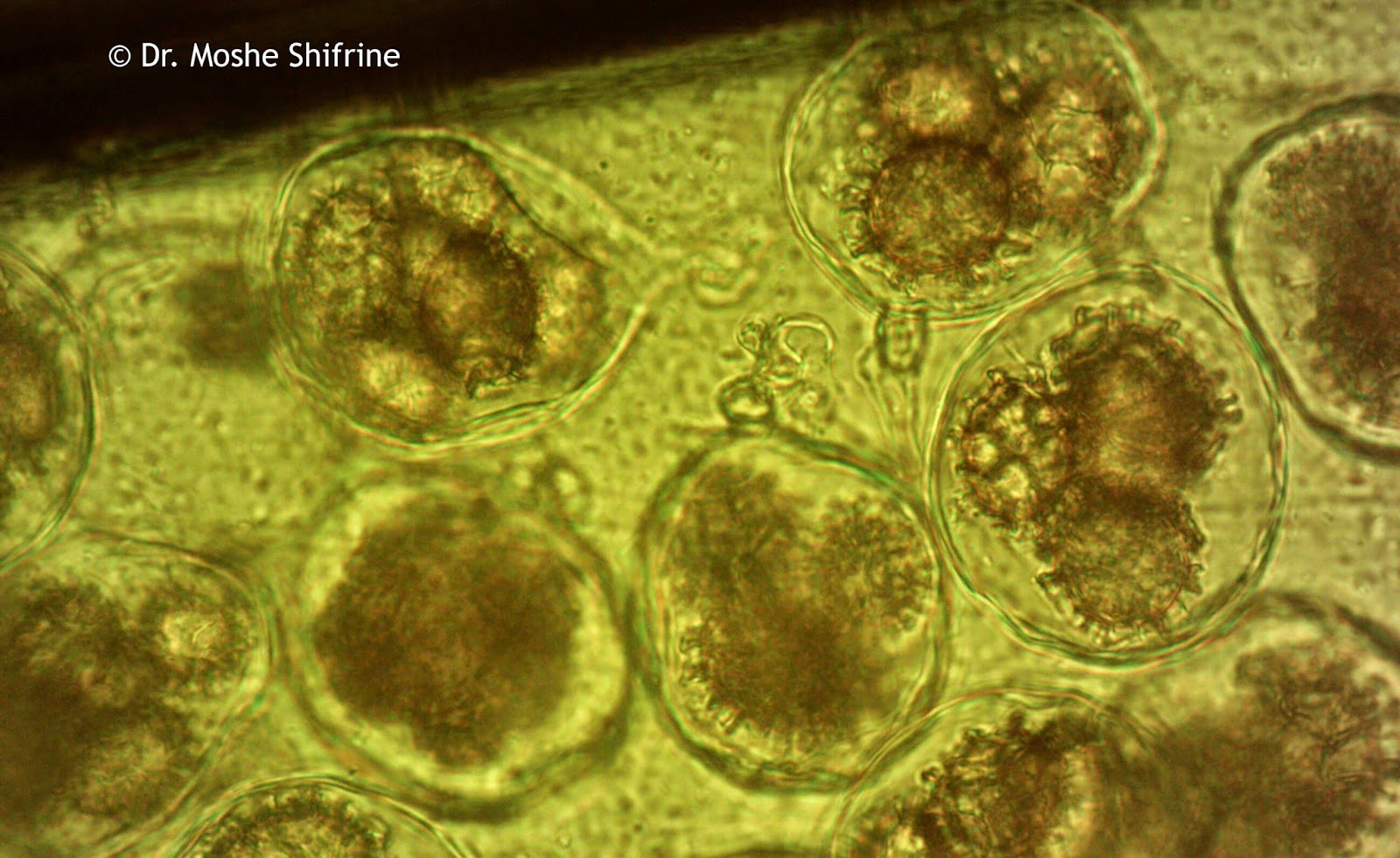 Funghi spore, 1000x, under biological microscope.