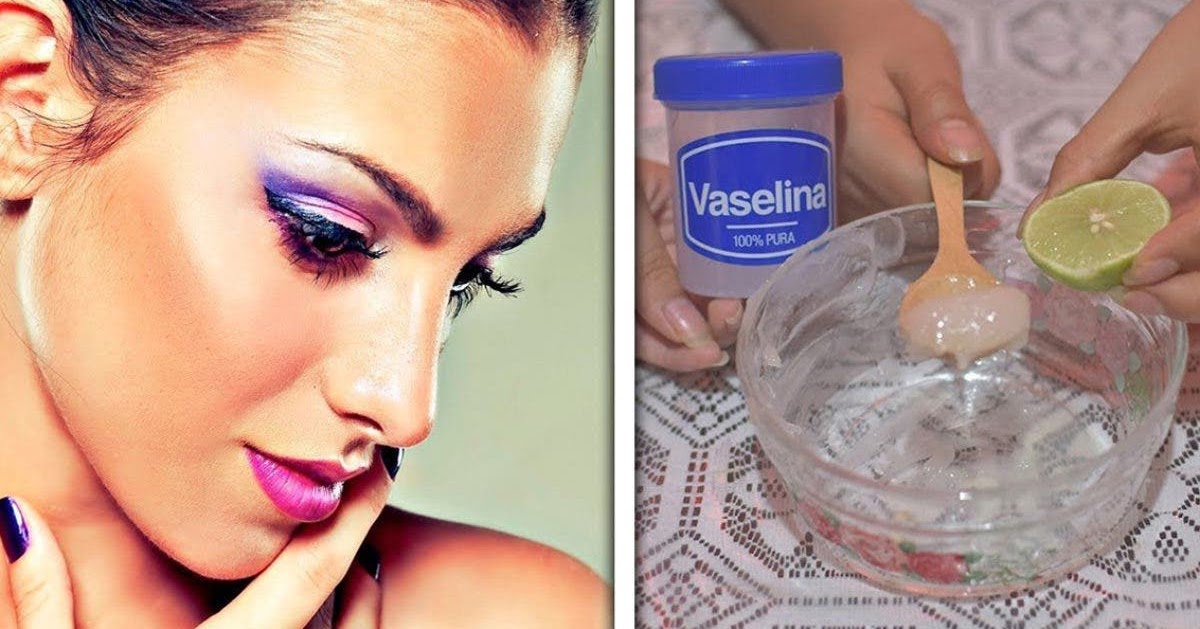 Lemon And Vaseline Recipe To Remove Wrinkles, Dry Skin And Have A