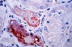 Nipah virus Nipah virus, virus