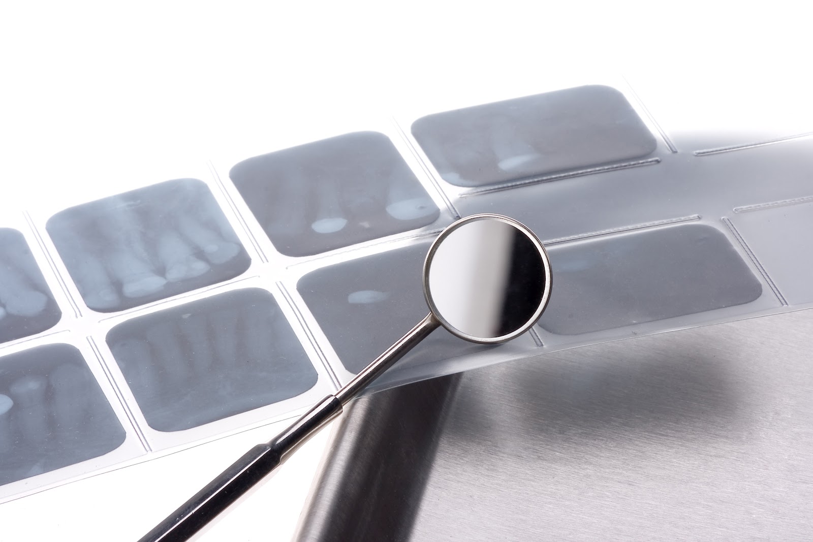 DiCiccio Orthodontics Can Dental Xrays cause Brain Cancer?