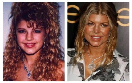 surgery before after plastic fergie wrong gone lift had celebrity brow implants nairaland boobs nose job society unknown thursday february