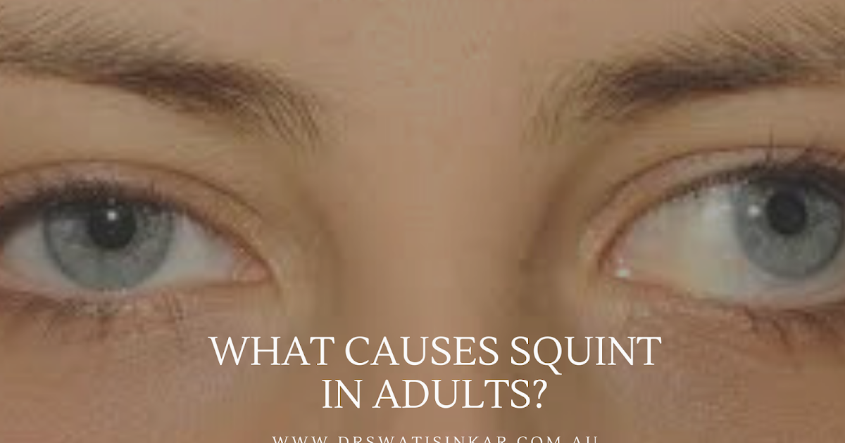 Dr. Swati Sinkar General and Paediatric Eye Specialist Adelaide SA Squint Can Affect Both