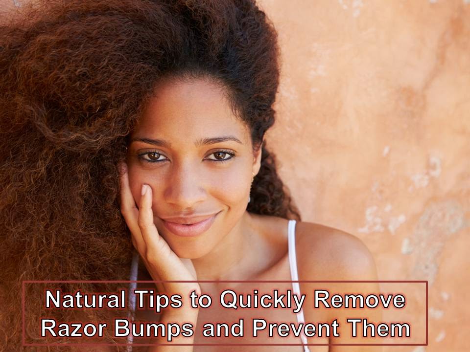 Amour All Naturals: Natural Tips to Remove Razor Bumps Quickly