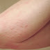 Causes Of Skin Rashes On Arms Treatment