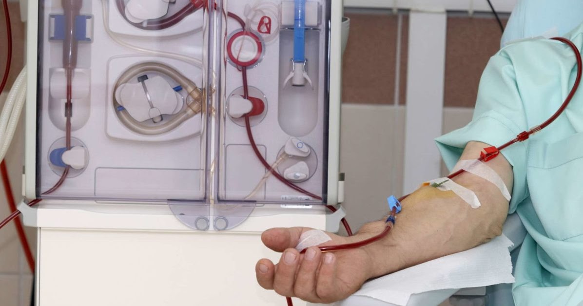 dietary-management-of-a-patient-undergoing-dialysis