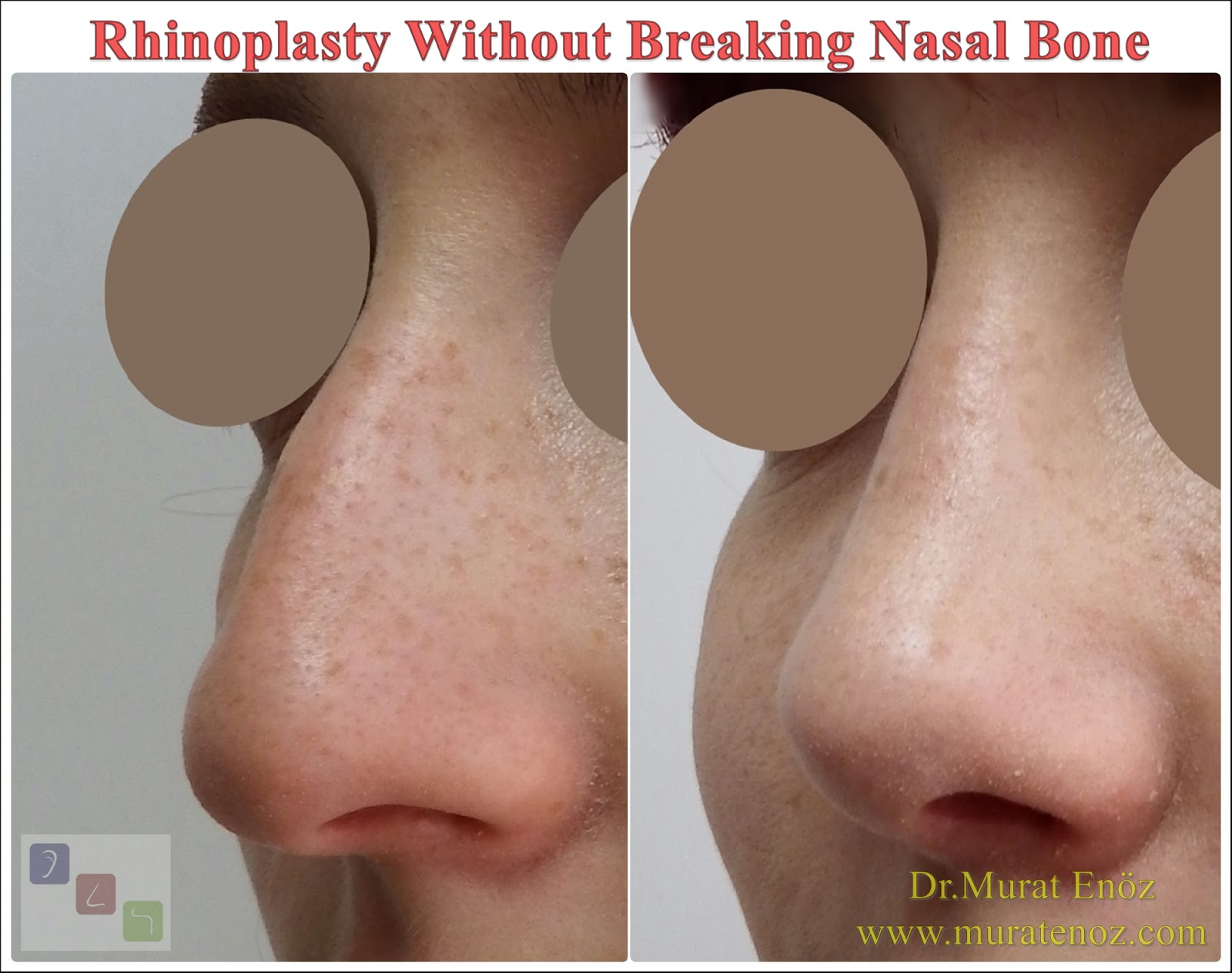 Without breaking. Without breaking. фото da buzz. Without breaking. пьер шмидт da buzz.