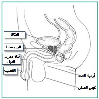 أعراض تضخم البروستاتا وهل يمكن علاج تضخم البروستاتا؟