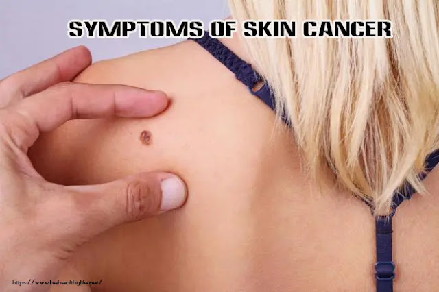 Skin Cancer Symptoms