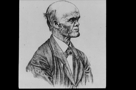 Dentistry and Medicine: Ectodermal Dysplasia and Treatment of children ...