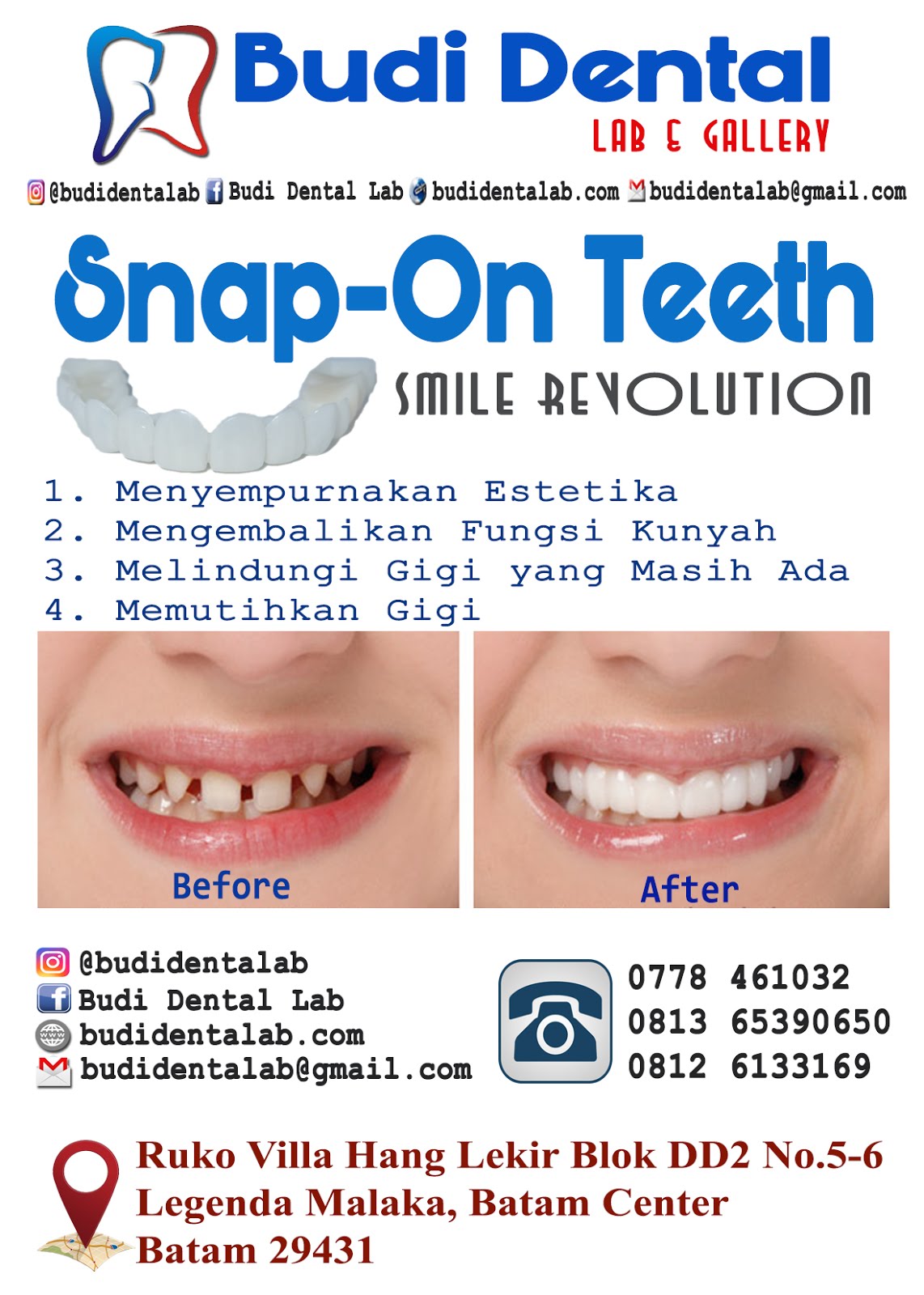 Snap-On Teeth