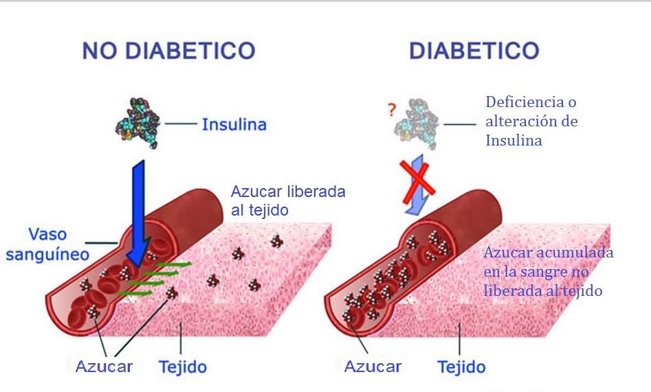 La insulina adelgaza