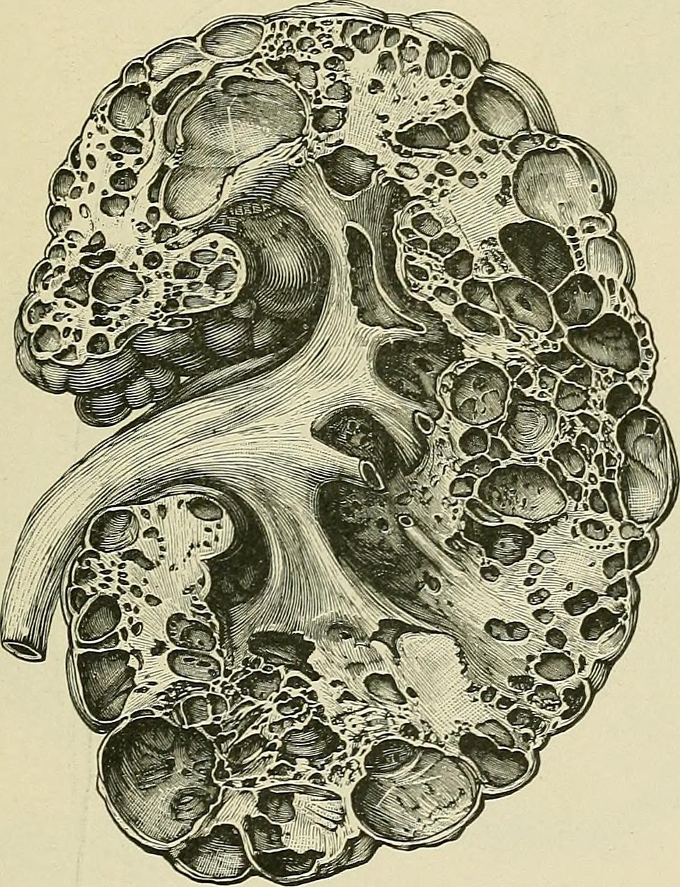 Have you ever come across this condition?