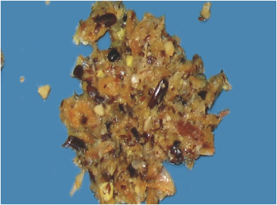 Proventriculus and Gizzard - Kesehatan unggas