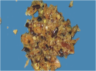 Proventriculus and Gizzard - Kesehatan unggas