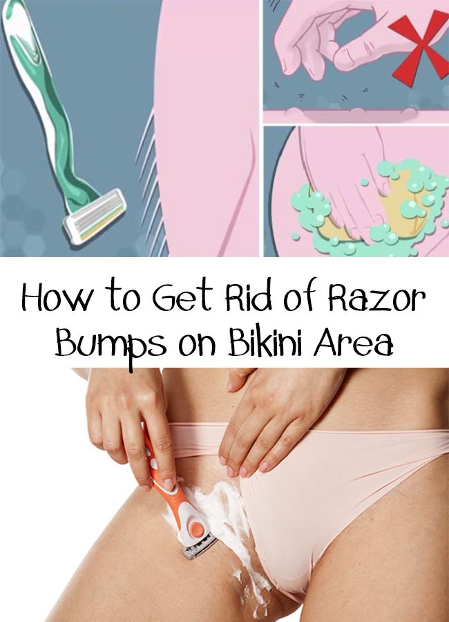 Bollymeditube How To Prevent Razor Bumps On Vagina