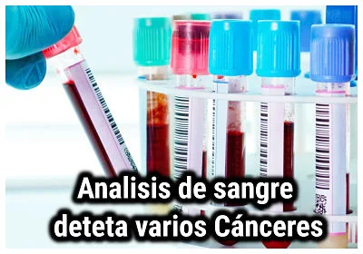 El análisis de sangre puede detectar muchos cánceres ocultos 