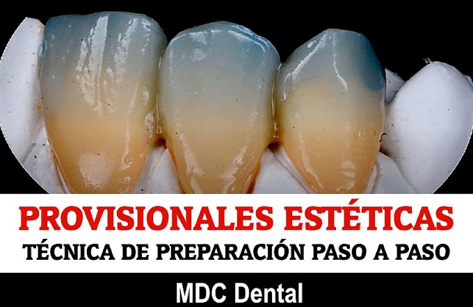 ODONTO-ESTOMATOLOGICA: SECUENCIA DE PRUEBAS EN CONSULTA PARA CONFECCION DE CORONA  METAL-CERÁMICA EN PORCELANA