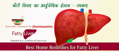 Home-Remedies-for-Fatty-Liver-in-Hindi, Fatty-Liver-KA ILAJ-UPCHAR फैटी लिवर आर्युवेदिक ईलाज - उपचार, Home Remedies for Fatty Liver in Hindi ,Fatty Liver KA ILAJ UPCHAR, Fatty Liver Ayurvedic Medicine, Fatty liver Ilaj, Liver ke gharelu upay