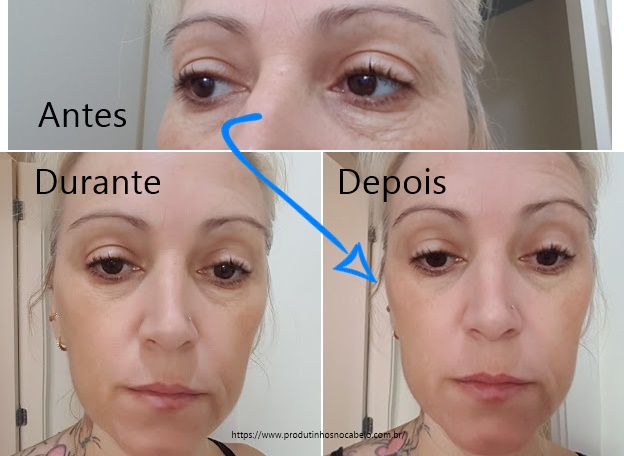 resultado antes e depois renew ultimate firmador