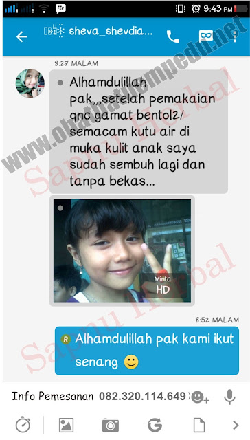 Cara Menghilangkan Keloid Bekas Operasi Cara Menghilangkan Keloid Bekas Operasi