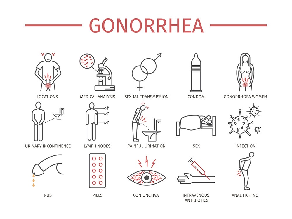 presentation of gonorrhea