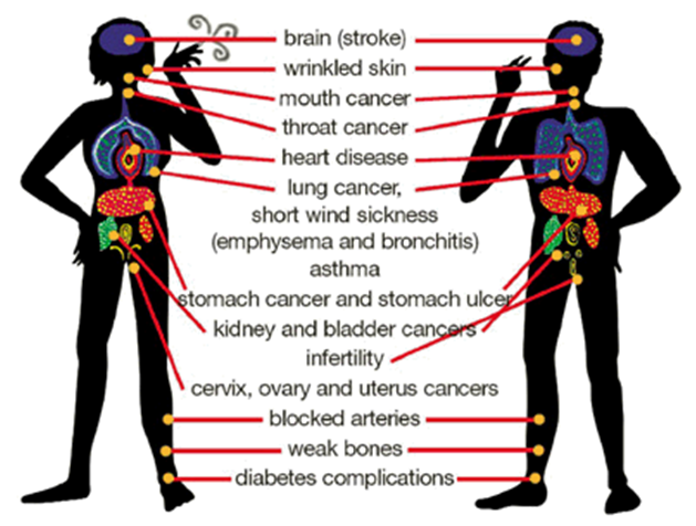 хроническая обструктивная болезнь лёгких. Mental health risks of smoking. органы дыхания при курении. The dangers of passive smoking. курение.