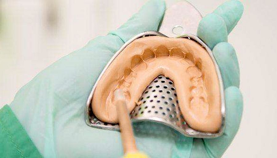 taking dental impression taking dental impression