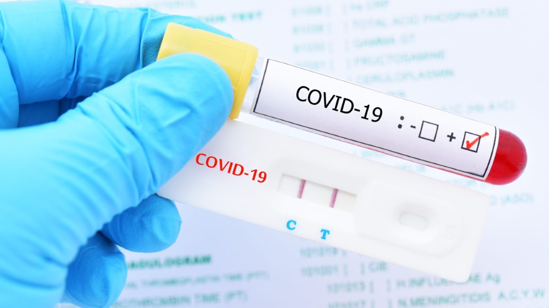 prueba-rapida-de-coronavirus