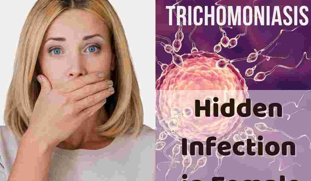 What is Trichomoniasis in Females, Hidden Symptoms,Prevention And Cure