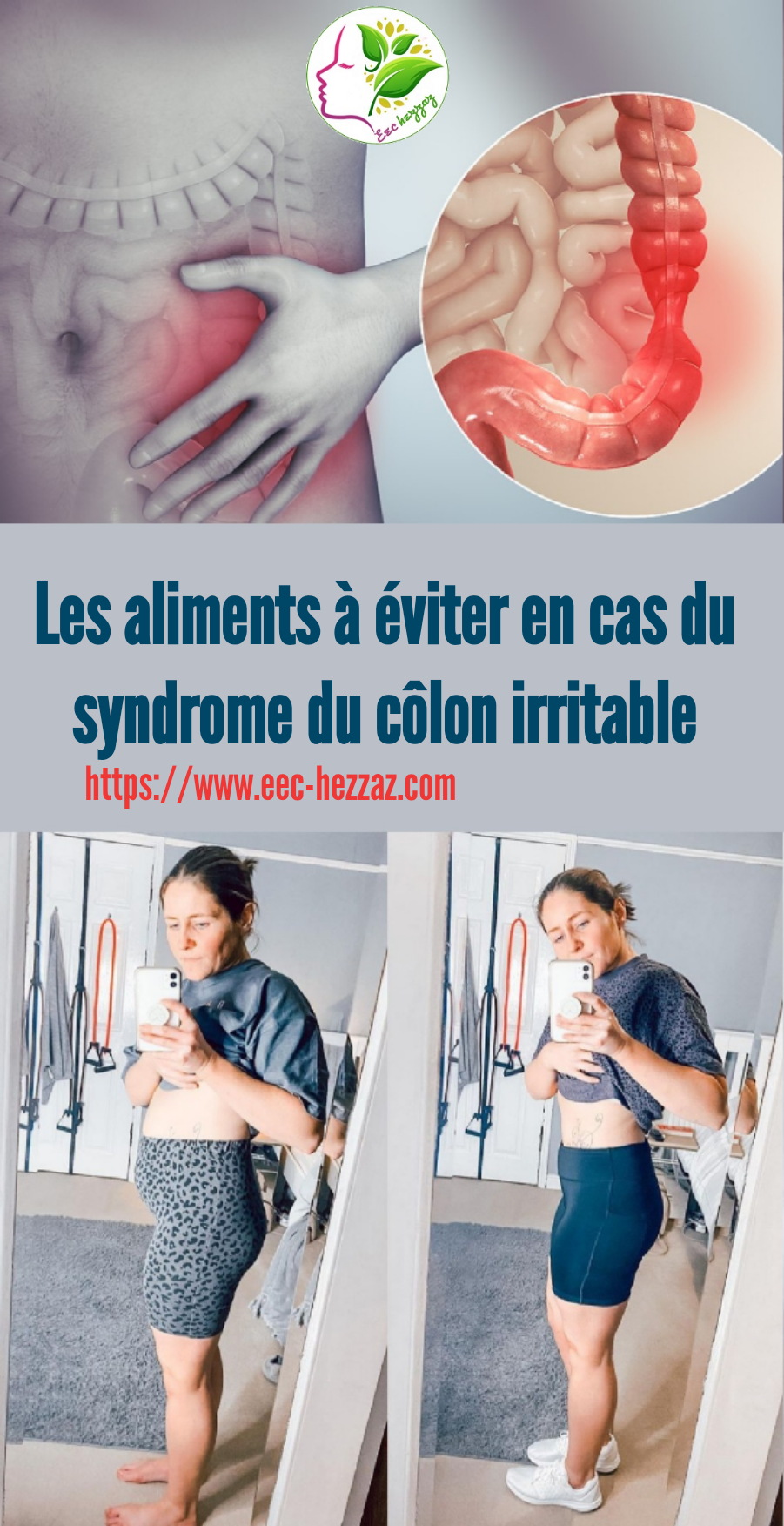 Les aliments à éviter en cas du syndrome du côlon irritable