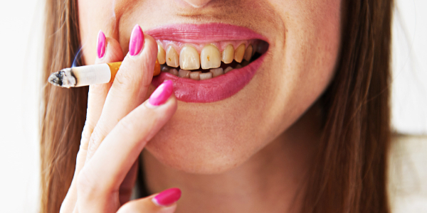 nicotine teeth stained fix affects way dental understand should