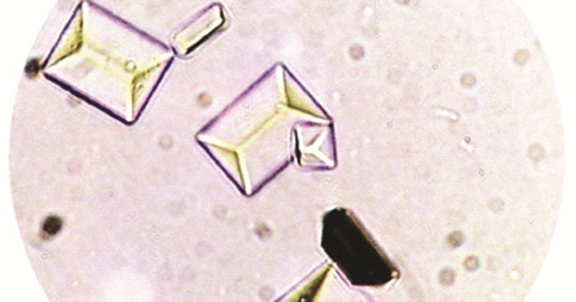 Kristal Sedimen Urin yang Sering Ditemukan - seri Edukasi Teknologi Laborat...