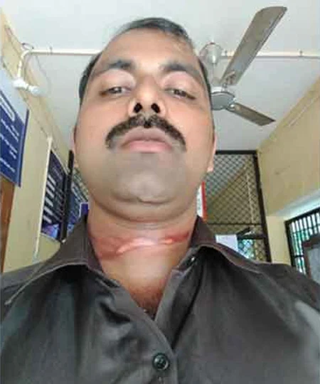 Bike traveler injured in Kollam, Kollam, News, Police, Injured, Auto & Vehicles, Pathanamthitta, Bike, Kerala