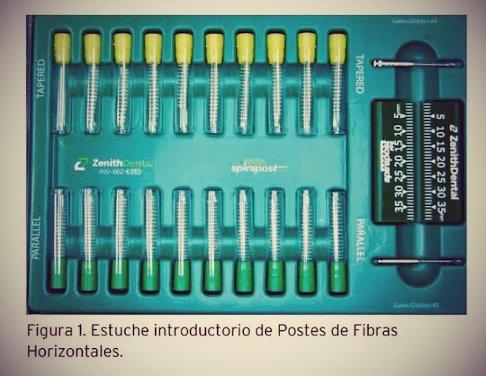 PDF: Postes de fibras horizontales