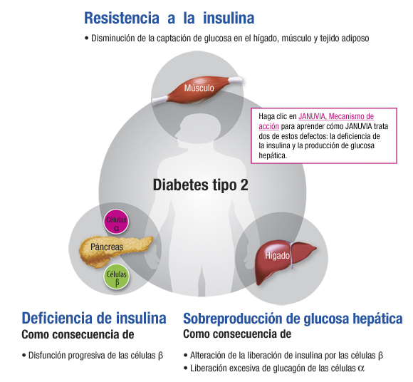 Tratamiento Diabetes Tipo Ii