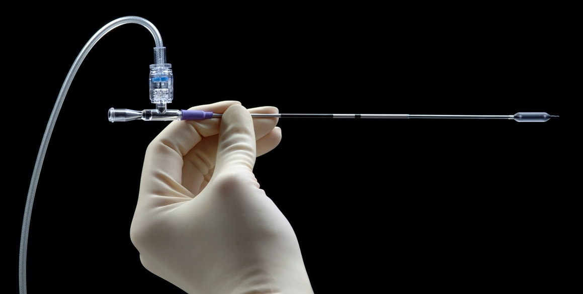 Balloon Sinuplasty Technique, Indications, Contraindications, Cost and Postprocedure Care