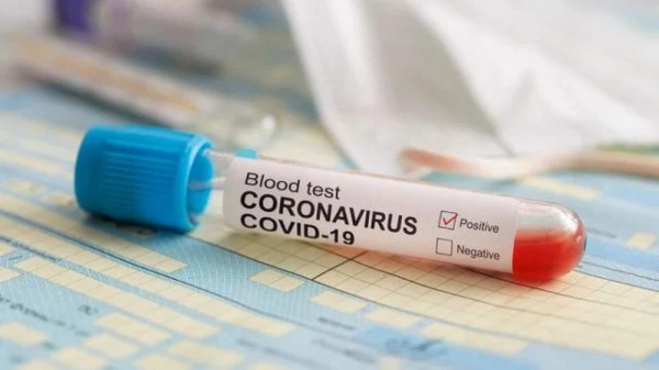 Muscat, News, Gulf, World, COVID19, Health, Patient, Trending, Health ministry, Oman, Oman registers 74 new coronavirus cases