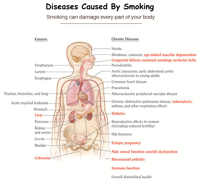 The Health Effects of Cigarette Smoking Health And Medical Information