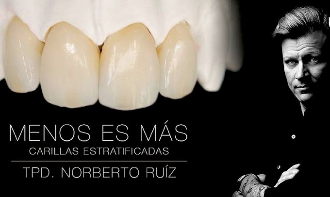 WEBINAR: Carillas Dentales Estratificadas - TPD Norberto Ruíz 