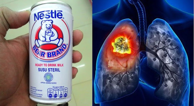 Bukan Air Soda, Tapi Susu Beruang yang Mampu Membersihkan Paru-Paru Secara Alami, Dijamin Gak Akan Sesak-sesak Lagi Susu%2BBeruang