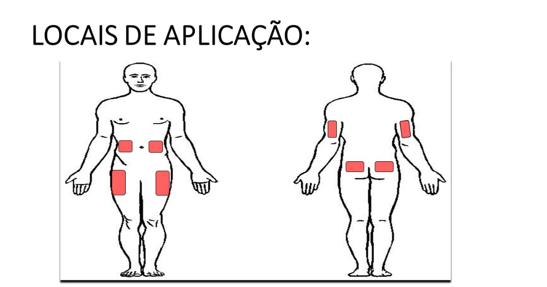 Blog da SBEM-RS: Aplicação de insulinas: o que eu preciso saber?