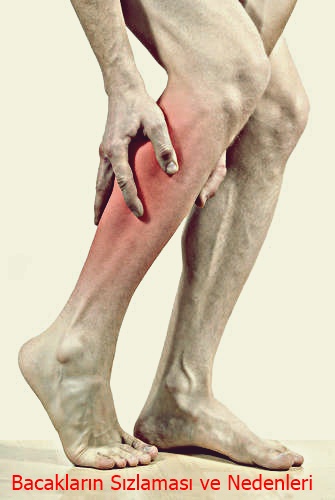 bacaklarin sizlamasi ve nedenleri